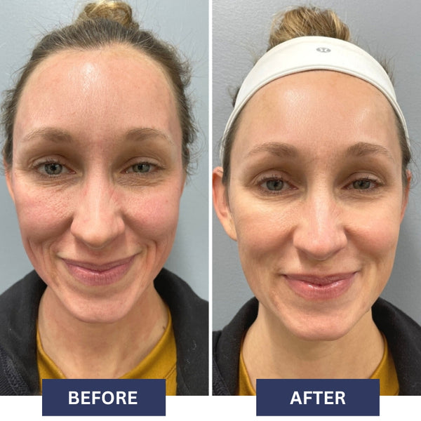 BEFORE (99).jpg__PID:6a7f885e-f5e0-4499-90be-9ae5f5e5aaf5